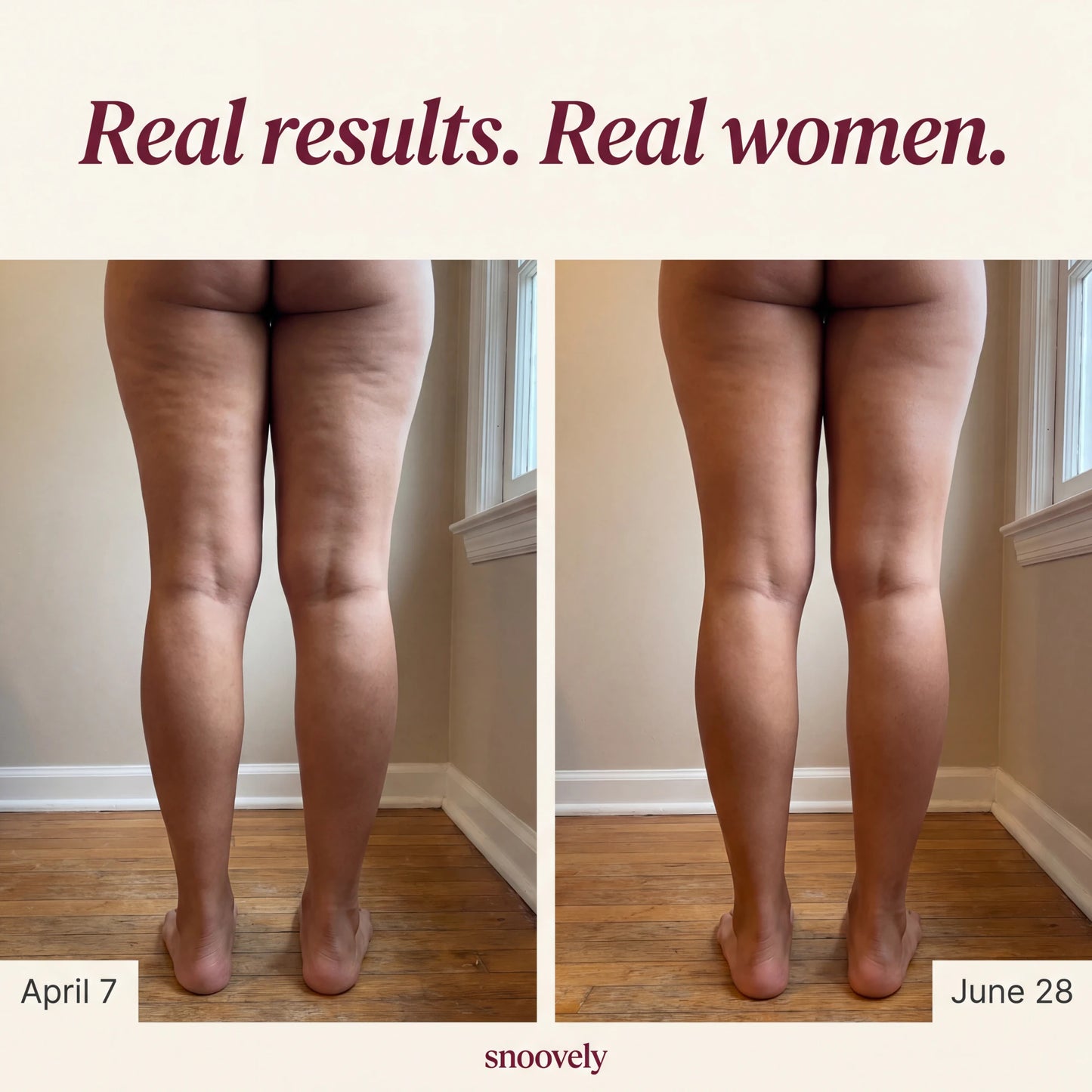 Snoovely 3D Anti-Cellulite Leggings
