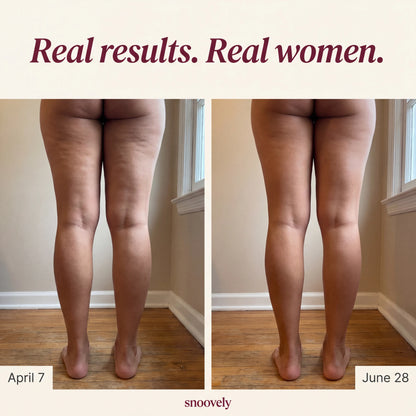 Snoovely 3D Anti-Cellulite Leggings