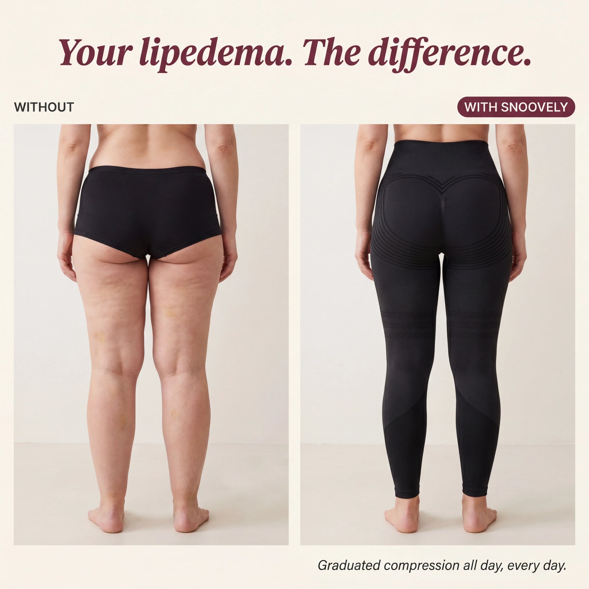 Your lipedema. The difference. - Without/With Snoovely