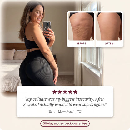 Snoovely 3D Anti-Cellulite Leggings